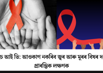 এইচ আই ভি: আওকাণ নকৰিব জ্বৰ আৰু মূৰৰ বিষৰ দৰে প্ৰাৰম্ভিক লক্ষণক