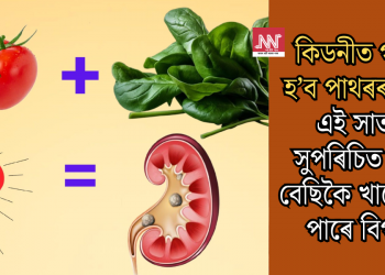 কিডনীত গঠন হ’ব পাথৰৰ খনি! এই সাতটা সুপৰিচিত খাদ্য বেছিকৈ খালে হ’ব পাৰে বিপদ!