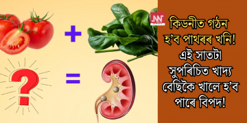 কিডনীত গঠন হ’ব পাথৰৰ খনি! এই সাতটা সুপৰিচিত খাদ্য বেছিকৈ খালে হ’ব পাৰে বিপদ!