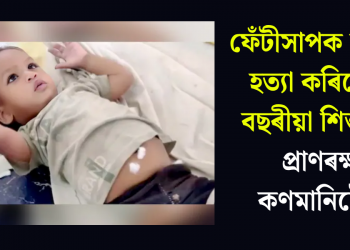 ফেঁটীসাপক কামুৰি হত্যা কৰিলে ১ বছৰীয়া শিশুৱে, প্ৰাণৰক্ষা কণমানিটোৰ