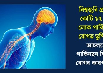 বিশ্বজুৰি প্ৰায় ১ কোটি ১৭ লাখ লোক পাৰ্কিনছন ৰোগত ভুগিছে ! আচলতে পাৰ্কিনছন কি, এই ৰোগৰ কাৰণ কি ?