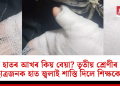 হাতৰ আখৰ কিয় বেয়া? তৃতীয় শ্ৰেণীৰ ছাত্ৰজনক হাত জ্বলাই শাস্তি দিলে শিক্ষকে!