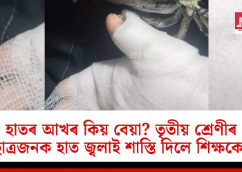 হাতৰ আখৰ কিয় বেয়া? তৃতীয় শ্ৰেণীৰ ছাত্ৰজনক হাত জ্বলাই শাস্তি দিলে শিক্ষকে!