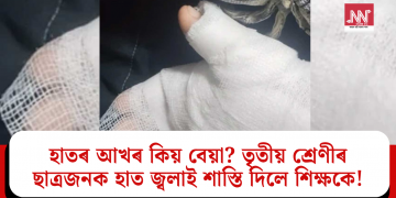 হাতৰ আখৰ কিয় বেয়া? তৃতীয় শ্ৰেণীৰ ছাত্ৰজনক হাত জ্বলাই শাস্তি দিলে শিক্ষকে!