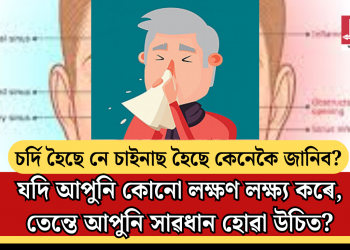 চৰ্দি হৈছে নে চাইনাছ হৈছে কেনেকৈ জানিব? যদি আপুনি কোনো লক্ষণ লক্ষ্য কৰে, তেন্তে আপুনি সাৱধান হোৱা উচিত?