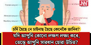 চৰ্দি হৈছে নে চাইনাছ হৈছে কেনেকৈ জানিব? যদি আপুনি কোনো লক্ষণ লক্ষ্য কৰে, তেন্তে আপুনি সাৱধান হোৱা উচিত?