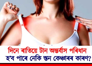 দিনে ৰাতিয়ে টান অন্তৰ্বাস পৰিধান : হ’ব পাৰে নেকি স্তন কেঞ্চাৰৰ কাৰণ?