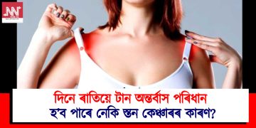 দিনে ৰাতিয়ে টান অন্তৰ্বাস পৰিধান : হ’ব পাৰে নেকি স্তন কেঞ্চাৰৰ কাৰণ?