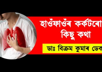 হাওঁ‌ফাওঁ‌ৰ কৰ্কটৰোগৰ কিছু কথা : ডাঃ বিক্ৰম কুমাৰ ডেকা