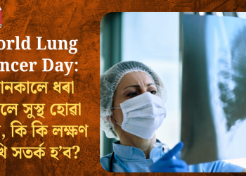 World Lung Cancer Day: সোনকালে ধৰা পৰিলে সুস্থ হোৱা সম্ভৱ, কি কি লক্ষণ দেখি সতৰ্ক হ’ব?