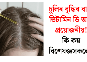 চুলিৰ বৃদ্ধিৰ বাবে ভিটামিন ডি অতি প্ৰয়োজনীয়! কি কয় বিশেষজ্ঞসকলে?