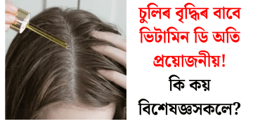 চুলিৰ বৃদ্ধিৰ বাবে ভিটামিন ডি অতি প্ৰয়োজনীয়! কি কয় বিশেষজ্ঞসকলে?