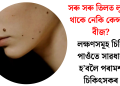 সৰু সৰু তিলত লুকাই থাকে নেকি কেন্সাৰৰ বীজ? লক্ষণসমূহ চিনি পাওঁতে সাৱধান হ’বলৈ পৰামৰ্শ চিকিৎসকৰ