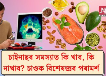 চাইনাছৰ সমস্যাত কি খাব, কি নাখাব? চাওক বিশেষজ্ঞৰ পৰামৰ্শ