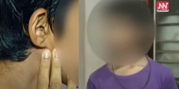শিক্ষকৰ প্ৰহাৰত গুৰুতৰ ভাবে আঘাত প্ৰাপ্ত হয় এজন ছাত্ৰ! বিদ্যালয়ৰ অধ্যক্ষৰ বিৰুদ্ধে তদন্তৰ দাবী