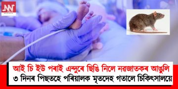 আই চি ইউ পৰাই এন্দুৰে ছিঙি নিলে নৱজাতকৰ আঙুলি : ৩ দিনৰ পিছতহে মৃতদেহ গতালে চিকিৎসালয়ে