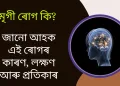 মৃগী ৰোগ কি? জানো আহক এই ৰোগৰ কাৰণ, লক্ষণ আৰু প্ৰতিকাৰ