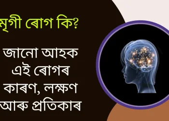 মৃগী ৰোগ কি? জানো আহক এই ৰোগৰ কাৰণ, লক্ষণ আৰু প্ৰতিকাৰ