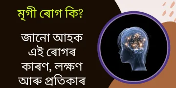 মৃগী ৰোগ কি? জানো আহক এই ৰোগৰ কাৰণ, লক্ষণ আৰু প্ৰতিকাৰ