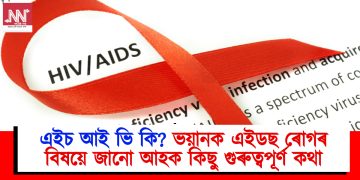 এইচ আই ভি কি? ভয়ানক এইডছ ৰোগৰ বিষয়ে জানো আহক কিছু গুৰুত্বপূৰ্ণ কথা