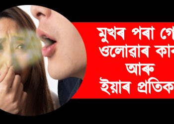 মুখৰ পৰা গোন্ধ ওলোৱাৰ কাৰণ আৰু ইয়াৰ প্ৰতিকাৰ