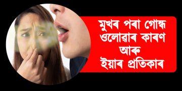 মুখৰ পৰা গোন্ধ ওলোৱাৰ কাৰণ আৰু ইয়াৰ প্ৰতিকাৰ