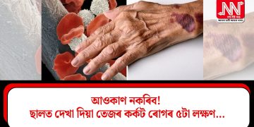 আওকাণ নকৰিব! ছালত দেখা দিয়া তেজৰ কৰ্কট ৰোগৰ ৫টা লক্ষণ…