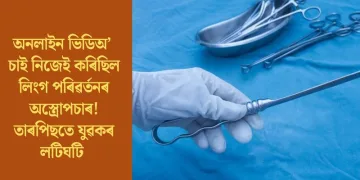 অনলাইন ভিডিঅ’ চাই নিজেই কৰিছিল লিংগ পৰিৱৰ্তনৰ অস্ত্ৰোপচাৰ! তাৰপিছতে যুৱকৰ লটিঘটি