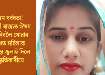 চৰম বৰ্বৰতা! যোগী ৰাজ্যত ঔষধ আনিবলৈ যোৱাৰ পথত মহিলাক জীৱন্ত জ্বলাই দিলে দুষ্কৃতিকাৰীয়ে