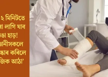 মাত্ৰ ২ মিনিটতে জোৰা লাগি যাব ভঙা হাড়! বিজ্ঞানীসকলে আৱিষ্কাৰ কৰিলে ‘মেজিক আঠা’