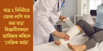 মাত্ৰ ২ মিনিটতে জোৰা লাগি যাব ভঙা হাড়! বিজ্ঞানীসকলে আৱিষ্কাৰ কৰিলে ‘মেজিক আঠা’
