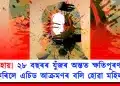 অসহায়! ২৮ বছৰৰ যুঁজৰ অন্তত ক্ষতিপূৰণ লাভ কৰিলে এচিড আক্ৰমণৰ বলি হোৱা মহিলাই