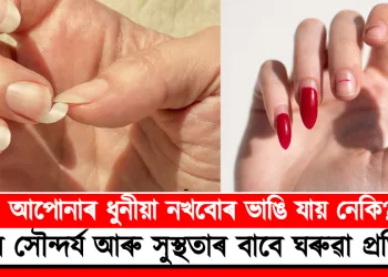 নখৰ সৌন্দৰ্য আৰু সুস্থতাৰ বাবে ঘৰুৱা প্ৰতিকাৰ