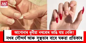 নখৰ সৌন্দৰ্য আৰু সুস্থতাৰ বাবে ঘৰুৱা প্ৰতিকাৰ