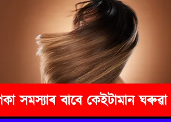 চুলি পকা সমস্যাৰ বাবে কেইটামান ঘৰুৱা উপায়