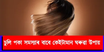 চুলি পকা সমস্যাৰ বাবে কেইটামান ঘৰুৱা উপায়