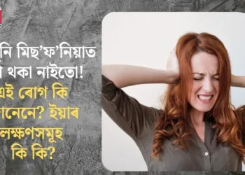 আপুনি মিছ’ফ’নিয়াত ভুগি থকা নাইতো! এই ৰোগ কি জানেনে? ইয়াৰ লক্ষণসমূহ কি কি?
