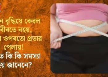 ওজন বৃদ্ধিয়ে কেৱল শৰীৰতে নহয়, ছালৰ ওপৰতো প্ৰভাৱ পেলায়! ছালত কি কি সমস্যা হয় জানেনে?