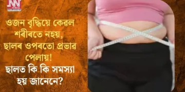 ওজন বৃদ্ধিয়ে কেৱল শৰীৰতে নহয়, ছালৰ ওপৰতো প্ৰভাৱ পেলায়! ছালত কি কি সমস্যা হয় জানেনে?