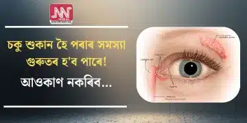 চকু শুকান হৈ পৰাৰ সমস্যা গুৰুতৰ হ’ব পাৰে! আওকাণ নকৰিব…