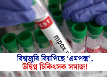 বিশ্বজুৰি বিয়পিছে ‘এমপক্স’, উদ্বিগ্ন চিকিৎসক সমাজ!