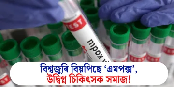 বিশ্বজুৰি বিয়পিছে ‘এমপক্স’, উদ্বিগ্ন চিকিৎসক সমাজ!