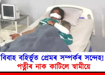 বিবাহ বহিৰ্ভূত প্ৰেমৰ সম্পৰ্কৰ সন্দেহ! পত্নীৰ নাক কাটিলে স্বামীয়ে