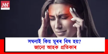 সঘনাই কিয় মূৰৰ বিষ হয়? জানো আহক প্ৰতিকাৰ