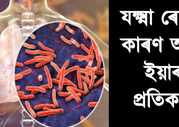 যক্ষ্মা ৰোগৰ কাৰণ আৰু ইয়াৰ প্ৰতিকাৰ