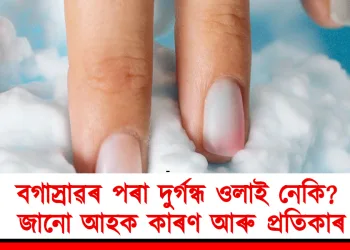 মহিলা স্বাস্থ্য : বগাস্ৰাৱৰ পৰা দুৰ্গন্ধ ওলাই নেকি? জানো আহক কাৰণ আৰু প্ৰতিকাৰ