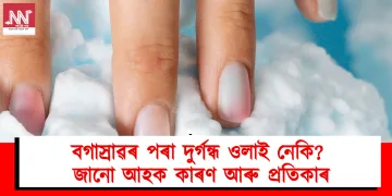 মহিলা স্বাস্থ্য : বগাস্ৰাৱৰ পৰা দুৰ্গন্ধ ওলাই নেকি? জানো আহক কাৰণ আৰু প্ৰতিকাৰ