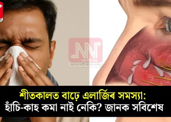 শীতকালত বাঢ়ে এলাৰ্জিৰ সমস্যা: হাঁচি-কাহ কমা নাই নেকি? জানক সবিশেষ
