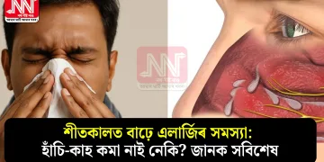 শীতকালত বাঢ়ে এলাৰ্জিৰ সমস্যা: হাঁচি-কাহ কমা নাই নেকি? জানক সবিশেষ