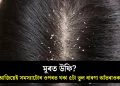 মূৰত উফি? আজিয়েই সমস্যাটোৰ ওপৰত থকা ৫টা ভুল ধাৰণা আঁতৰাওক